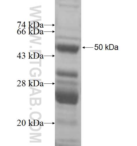 RPL15 fusion protein Ag9965 SDS-PAGE