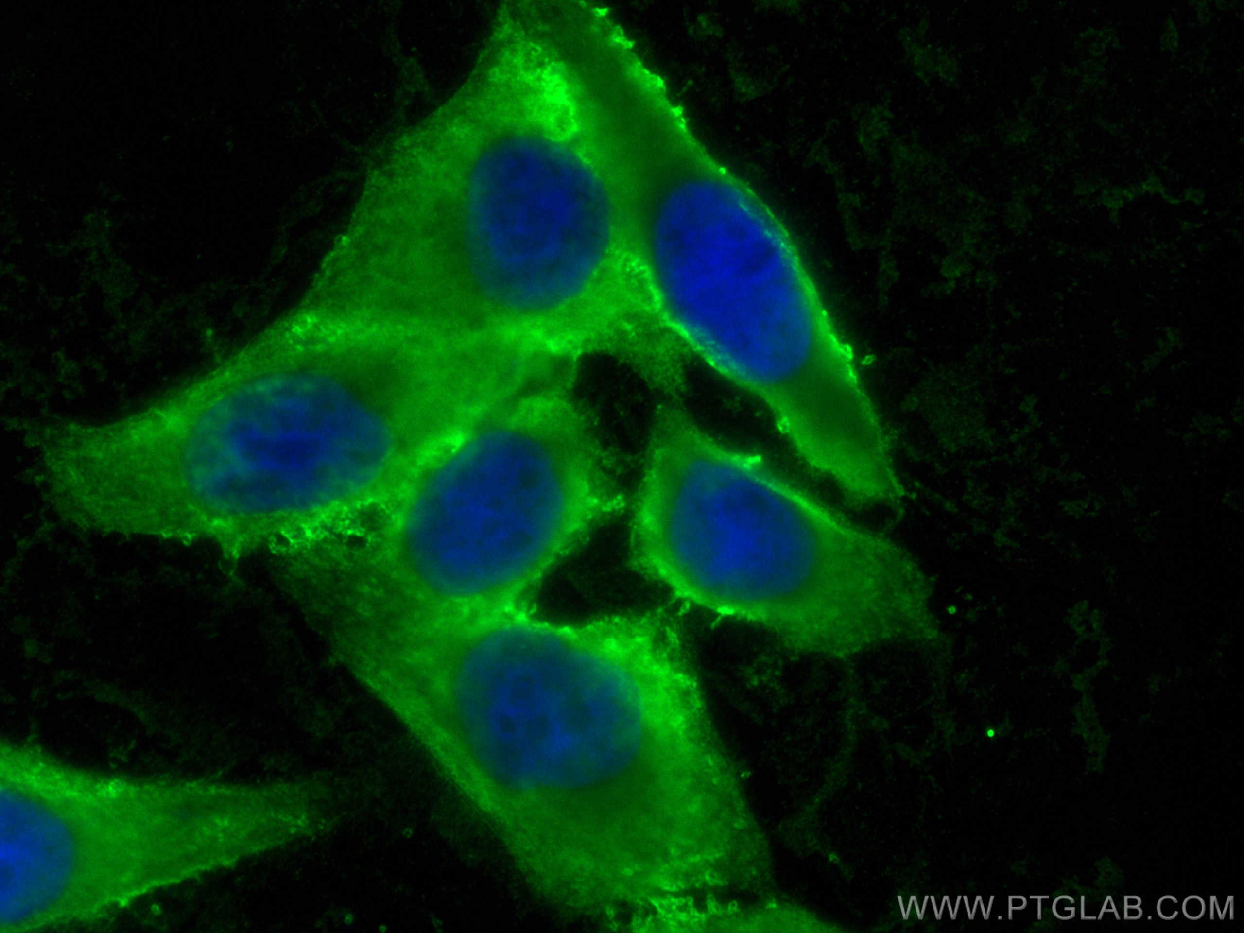 Immunofluorescence (IF) / fluorescent staining of HepG2 cells using RPL17 Monoclonal antibody (67223-1-Ig)