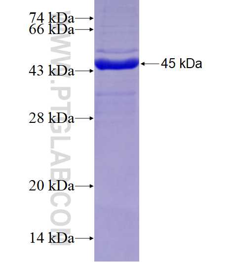 RPL17 fusion protein Ag5270 SDS-PAGE