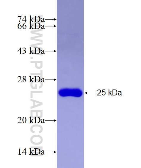 RPL17 fusion protein Ag5393 SDS-PAGE