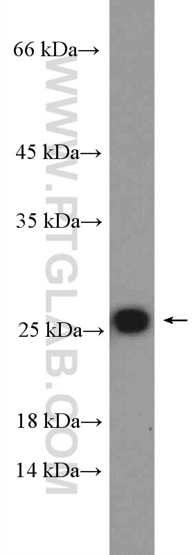 Western Blot (WB) analysis of HeLa cells using RPL18 Polyclonal antibody (17029-1-AP)