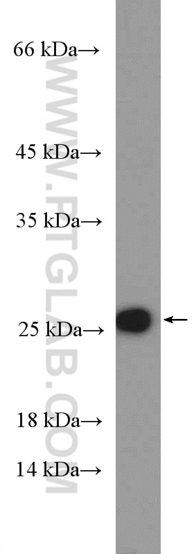 Western Blot (WB) analysis of HepG2 cells using RPL18 Polyclonal antibody (17029-1-AP)