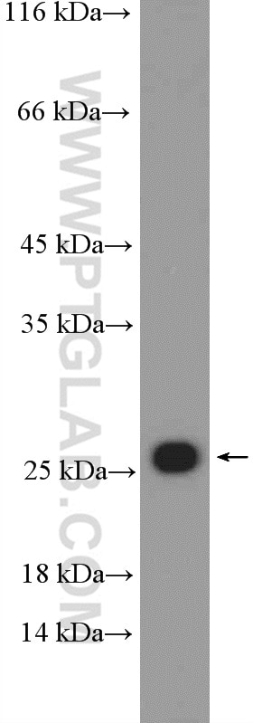 Western Blot (WB) analysis of HEK-293 cells using RPL18 Polyclonal antibody (17029-1-AP)
