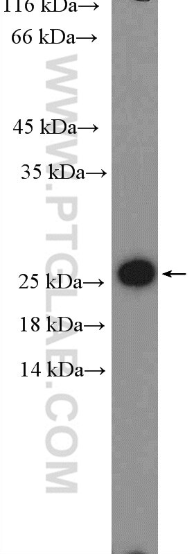 Western Blot (WB) analysis of HepG2 cells using RPL18 Polyclonal antibody (17029-1-AP)