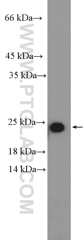 Western Blot (WB) analysis of HeLa cells using RPL18 Polyclonal antibody (17029-1-AP)