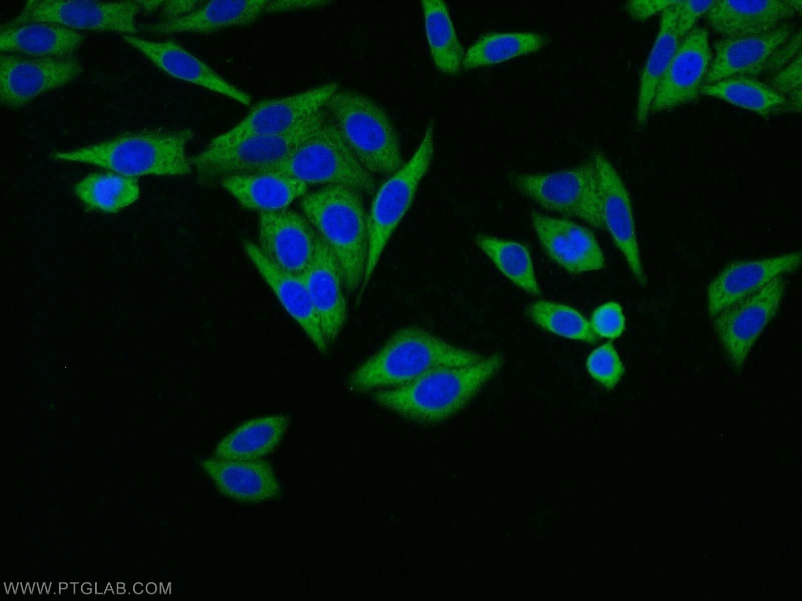Immunofluorescence (IF) / fluorescent staining of HepG2 cells using RPL18A Polyclonal antibody (14653-1-AP)