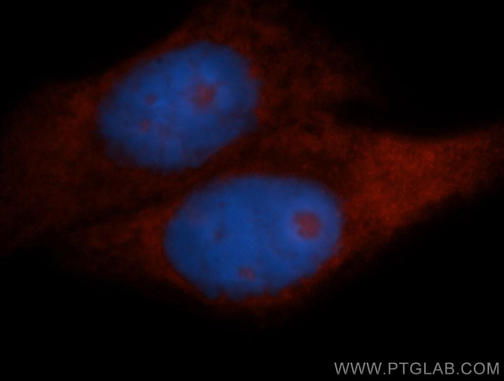 Immunofluorescence (IF) / fluorescent staining of HepG2 cells using RPL18A Polyclonal antibody (14653-1-AP)