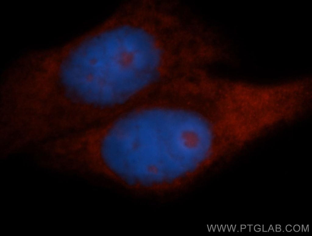 IF Staining of HepG2 using 14653-1-AP