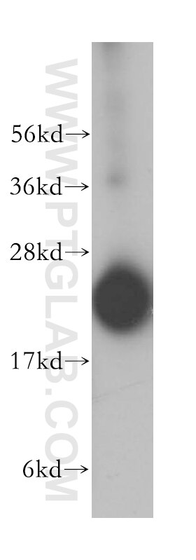 Western Blot (WB) analysis of HeLa cells using RPL18A Polyclonal antibody (14653-1-AP)