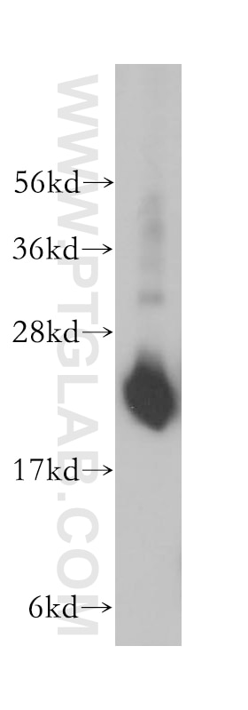 Western Blot (WB) analysis of human brain tissue using RPL18A Polyclonal antibody (14653-1-AP)