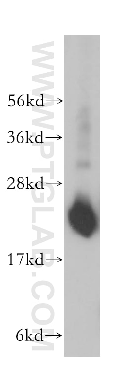 WB analysis of human brain using 14653-1-AP