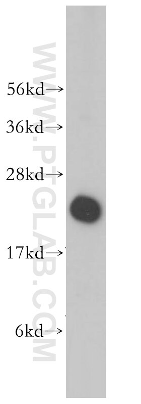 WB analysis of PC-3 using 14653-1-AP