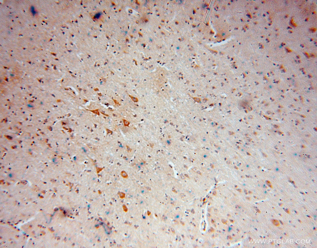 Immunohistochemistry (IHC) staining of human brain tissue using RPL18A Polyclonal antibody (15751-1-AP)