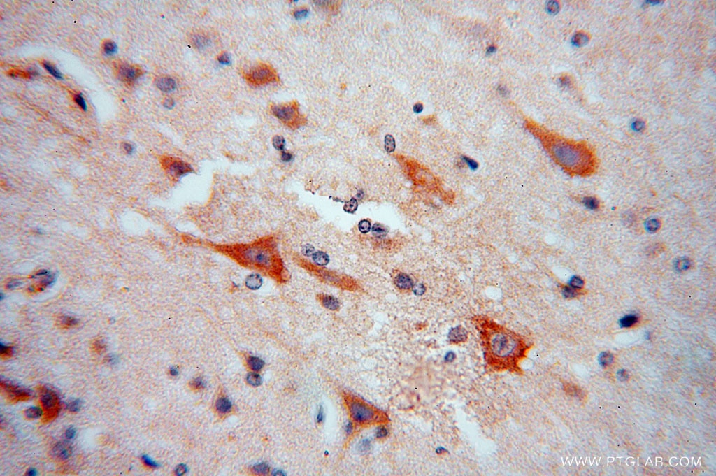 Immunohistochemistry (IHC) staining of human brain tissue using RPL18A Polyclonal antibody (15751-1-AP)