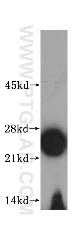 Western Blot (WB) analysis of HeLa cells using RPL18A Polyclonal antibody (15751-1-AP)