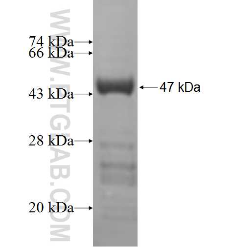 RPL18A fusion protein Ag6251 SDS-PAGE