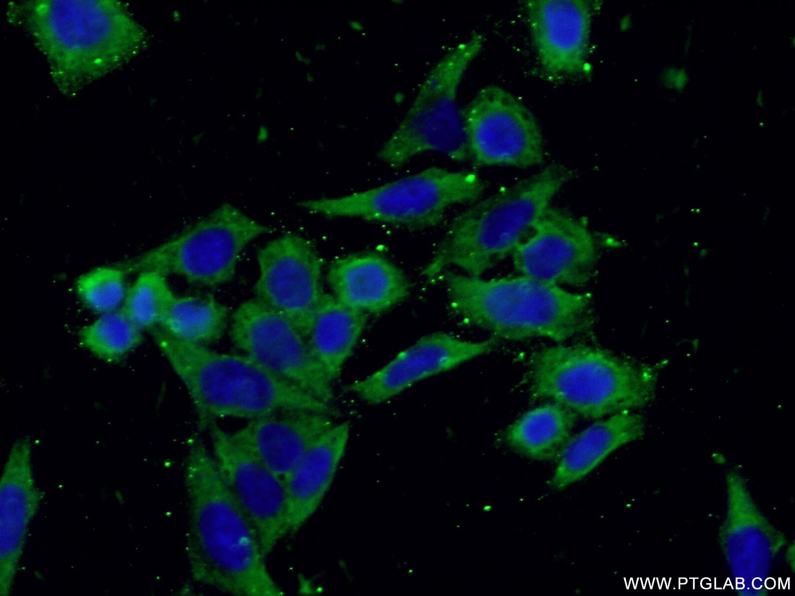 Immunofluorescence (IF) / fluorescent staining of HeLa cells using RPL19 Polyclonal antibody (14701-1-AP)