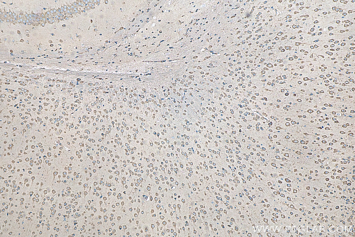 Immunohistochemistry (IHC) staining of mouse brain tissue using RPL19 Polyclonal antibody (14701-1-AP)