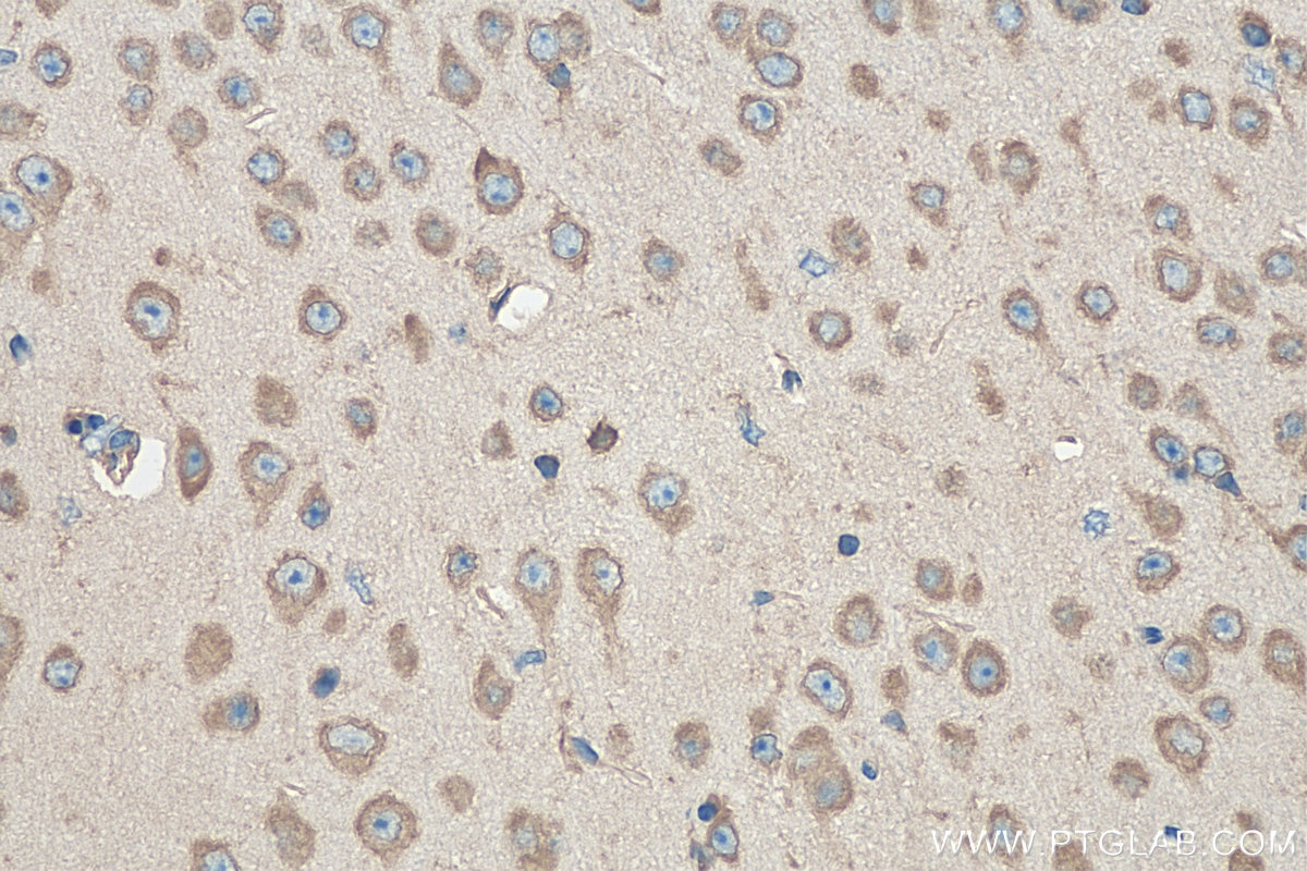 Immunohistochemistry (IHC) staining of mouse brain tissue using RPL19 Polyclonal antibody (14701-1-AP)