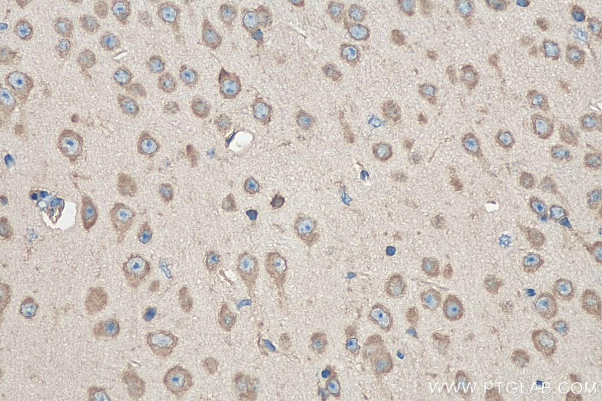 IHC staining of mouse brain using 14701-1-AP