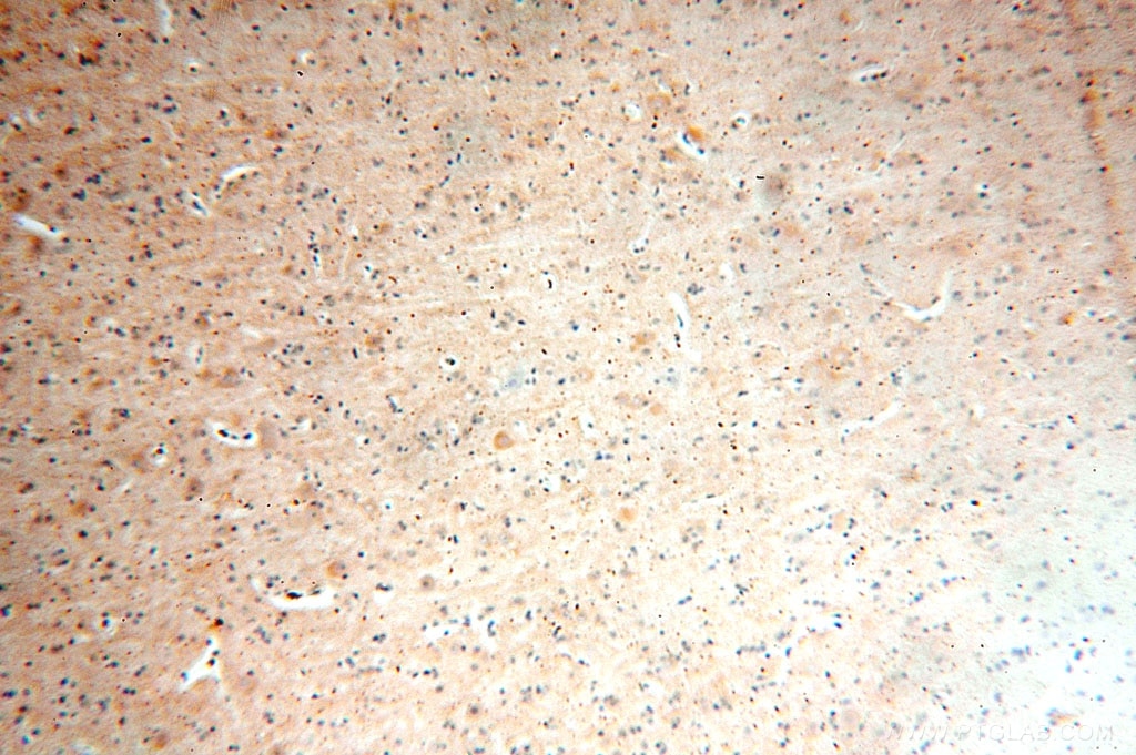 Immunohistochemistry (IHC) staining of human brain tissue using RPL19 Polyclonal antibody (14701-1-AP)