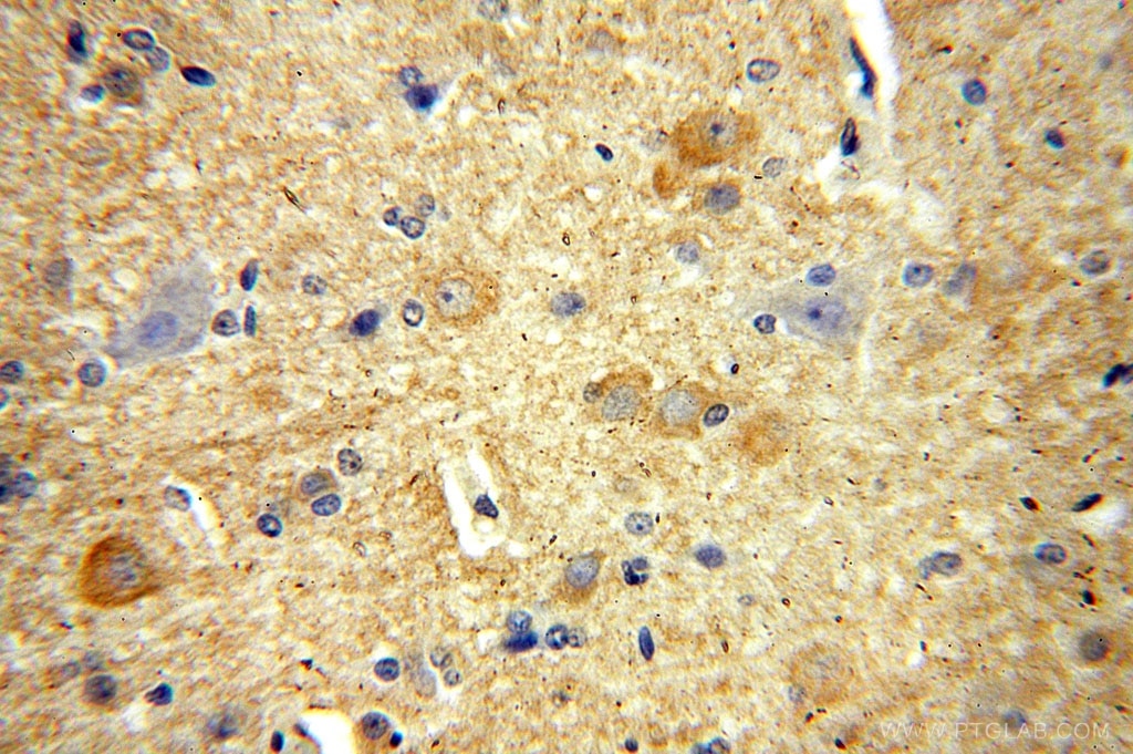 Immunohistochemistry (IHC) staining of human brain tissue using RPL19 Polyclonal antibody (14701-1-AP)