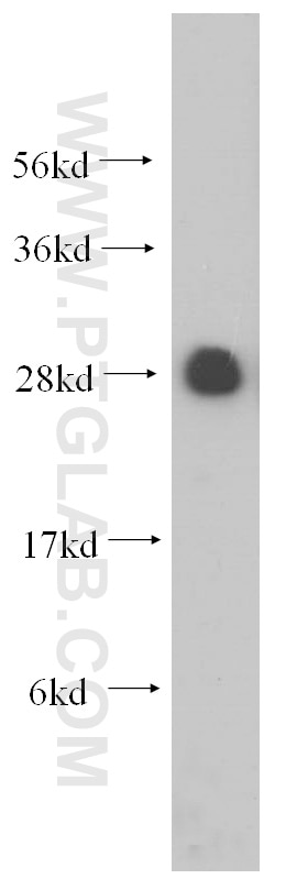 Western Blot (WB) analysis of HeLa cells using RPL19 Polyclonal antibody (14701-1-AP)