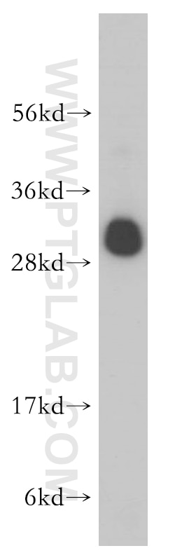 Western Blot (WB) analysis of PC-3 cells using RPL19 Polyclonal antibody (14701-1-AP)