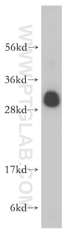 WB analysis of PC-3 using 14701-1-AP