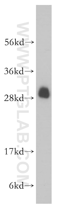 Western Blot (WB) analysis of MCF-7 cells using RPL19 Polyclonal antibody (14701-1-AP)