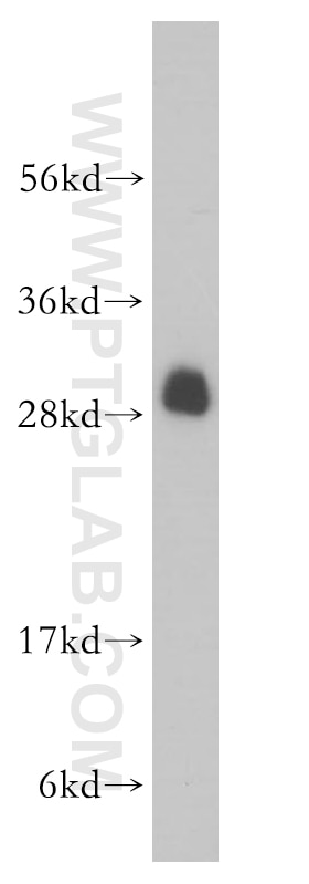 WB analysis of MCF-7 using 14701-1-AP