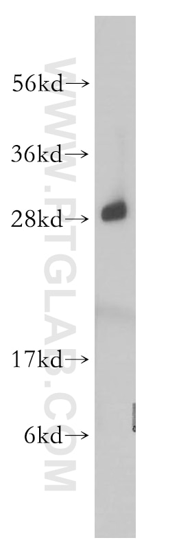 Western Blot (WB) analysis of mouse spleen tissue using RPL19 Polyclonal antibody (14701-1-AP)