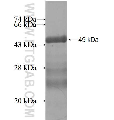 RPL19 fusion protein Ag8035 SDS-PAGE