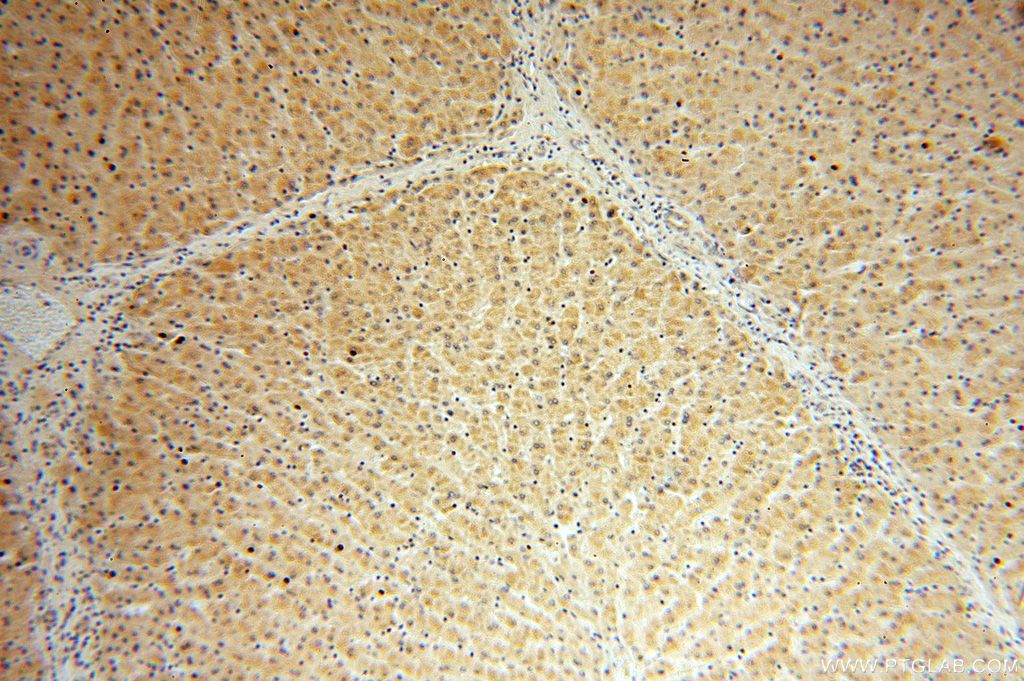 Immunohistochemistry (IHC) staining of human liver tissue using RPL21 Polyclonal antibody (15226-1-AP)