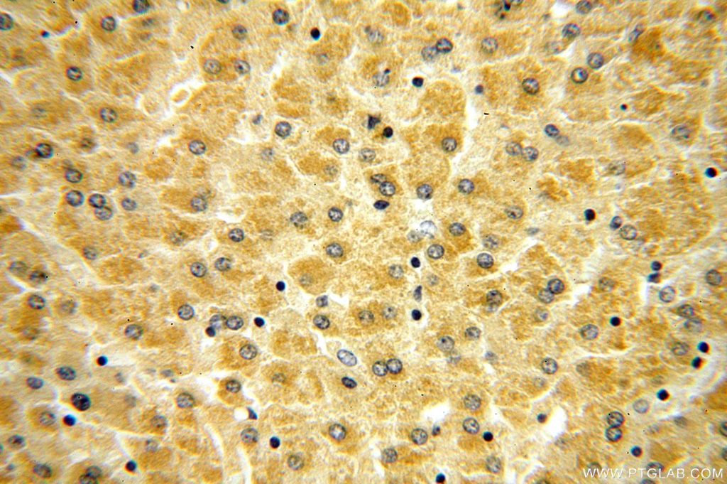 Immunohistochemistry (IHC) staining of human liver tissue using RPL21 Polyclonal antibody (15226-1-AP)