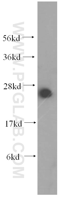 Western Blot (WB) analysis of HepG2 cells using RPL21 Polyclonal antibody (15226-1-AP)