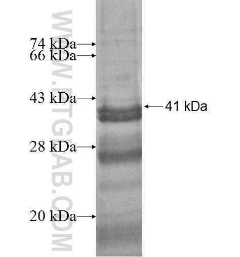 RPL21 fusion protein Ag7444 SDS-PAGE