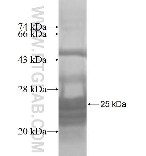 RPL21 fusion protein Ag7467 SDS-PAGE