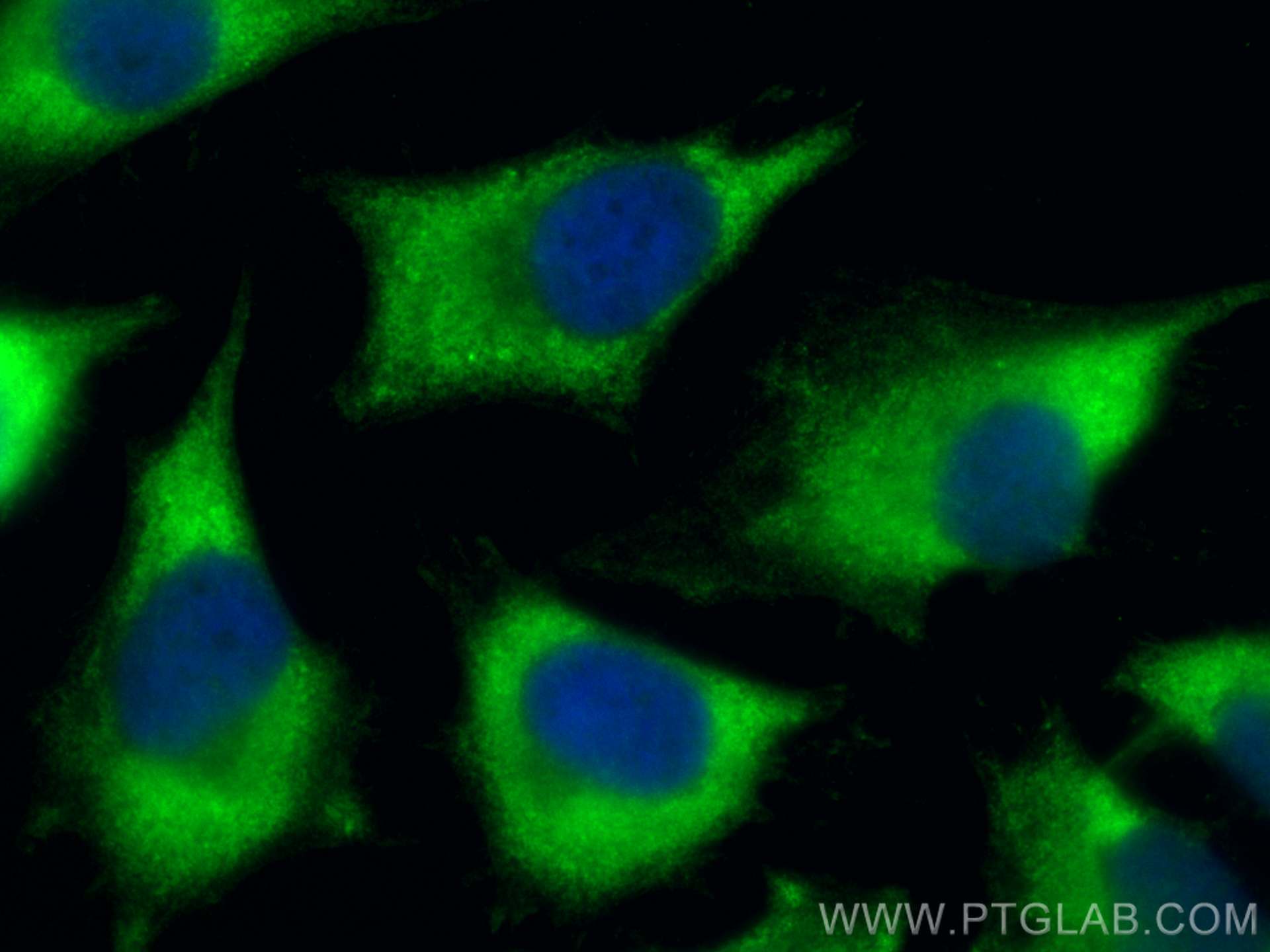 Immunofluorescence (IF) / fluorescent staining of HeLa cells using RPL22 Polyclonal antibody (25002-1-AP)