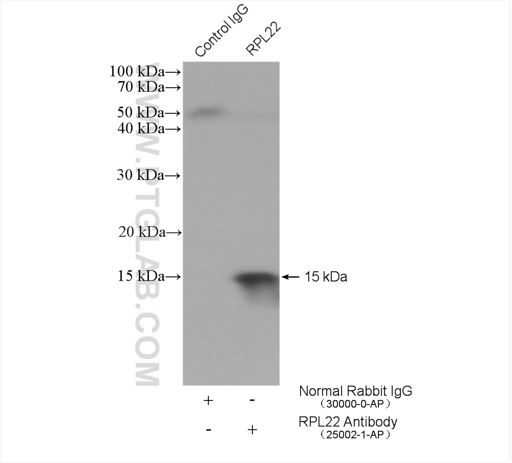 Immunoprecipitation (IP) experiment of A431 cells using RPL22 Polyclonal antibody (25002-1-AP)