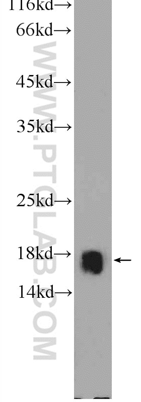 Western Blot (WB) analysis of A431 cells using RPL22 Polyclonal antibody (25002-1-AP)