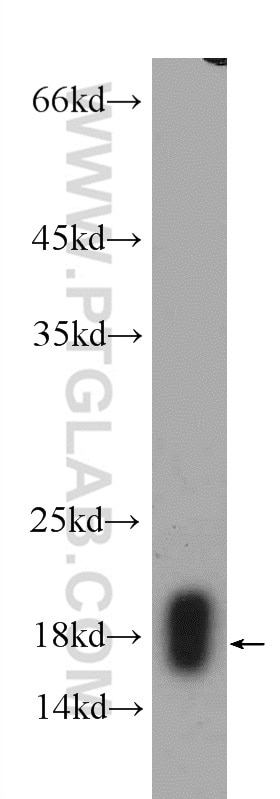 Western Blot (WB) analysis of Jurkat cells using RPL22 Polyclonal antibody (25002-1-AP)