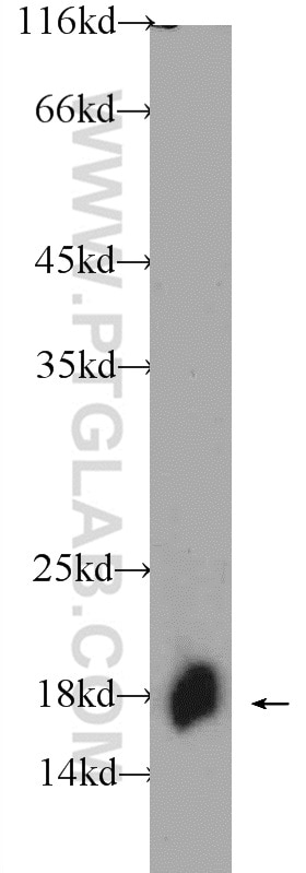 WB analysis of HeLa using 25002-1-AP