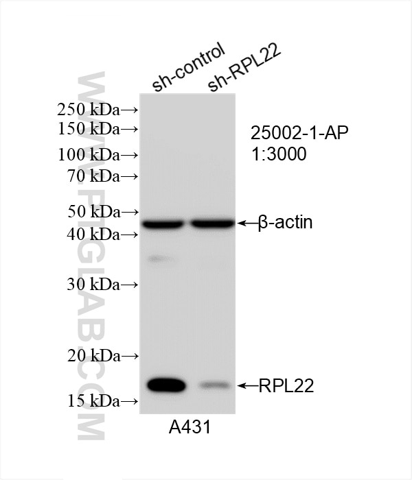 Western Blot (WB) analysis of A431 cells using RPL22 Polyclonal antibody (25002-1-AP)