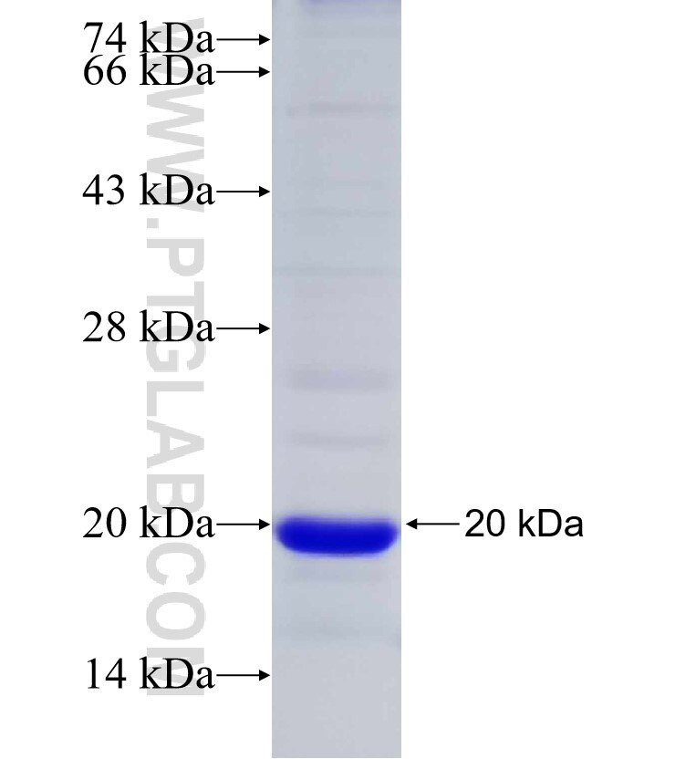 RPL22 fusion protein Ag30115 SDS-PAGE