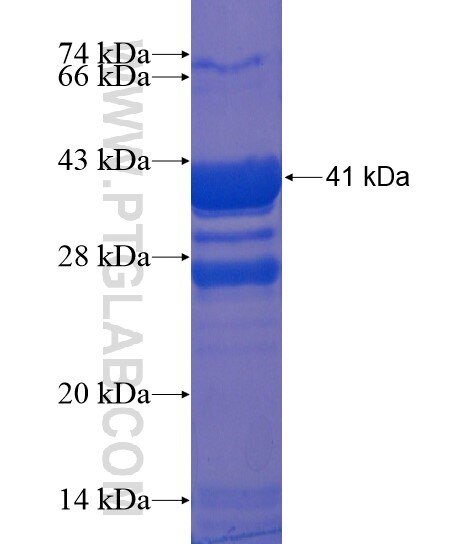 RPL22 fusion protein Ag21851 SDS-PAGE