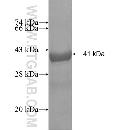 RPL22L1 fusion protein Ag10156 SDS-PAGE