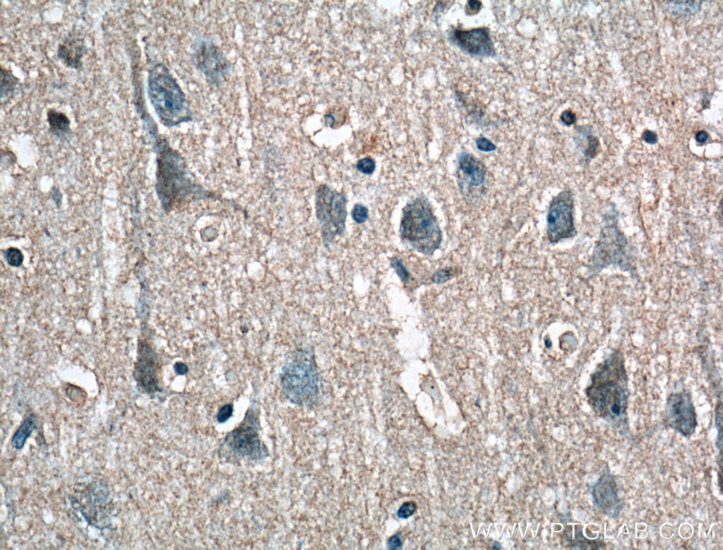Immunohistochemistry (IHC) staining of human brain tissue using RPL23 Polyclonal antibody (16086-1-AP)