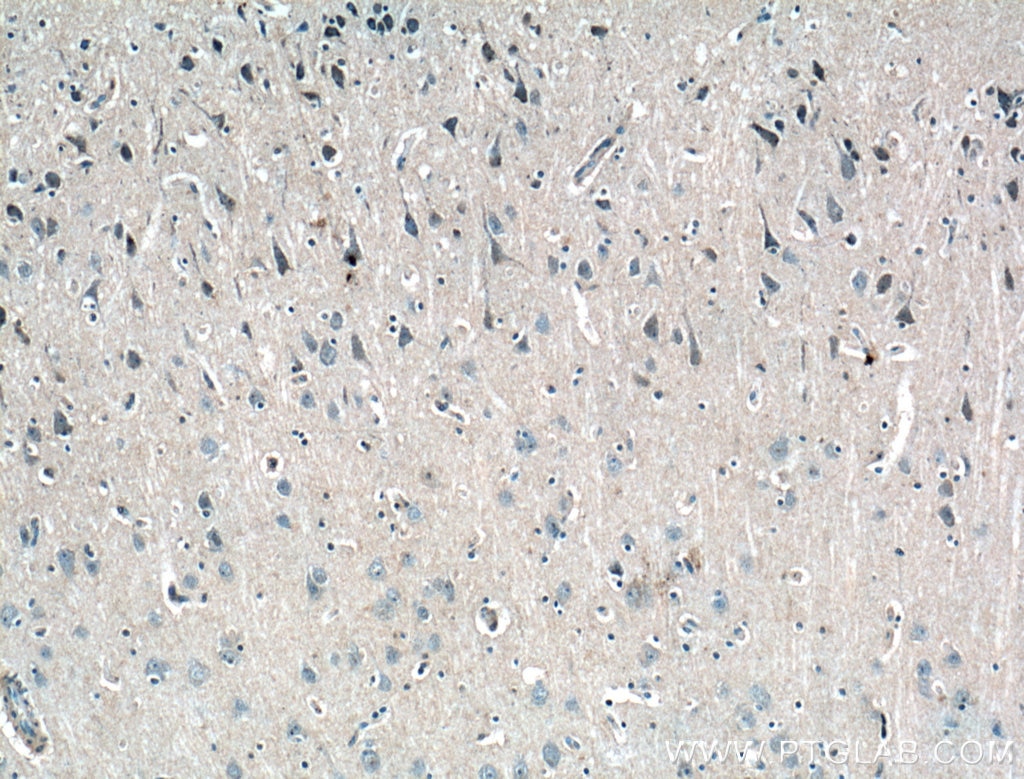 Immunohistochemistry (IHC) staining of human brain tissue using RPL23 Polyclonal antibody (16086-1-AP)