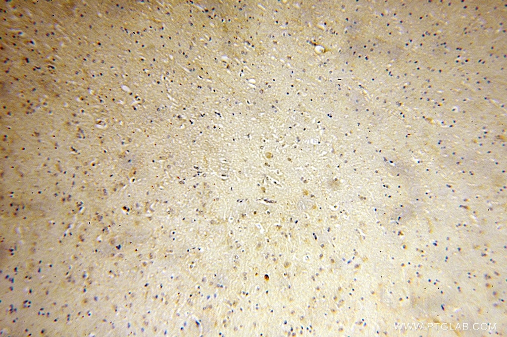 IHC staining of human brain using 16086-1-AP